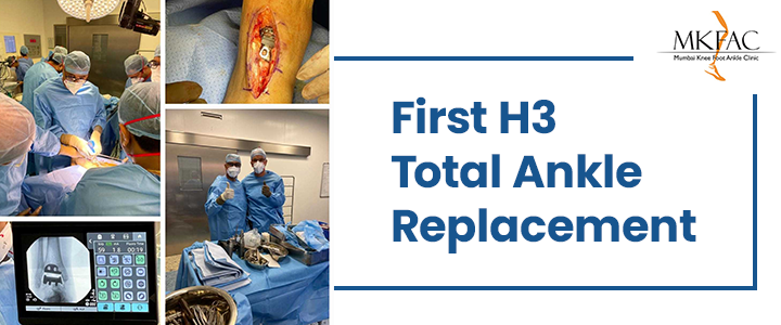 H3 Total Ankle Replacement Surgery in Mumbai