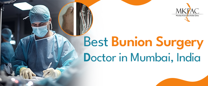 Best Bunion Surgery Doctor in Mumbai India