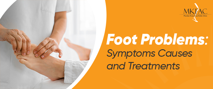 Foot Problems: Symptoms, Causes and Treatments