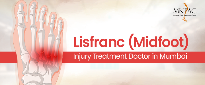 Lisfranc Injury Treatment Doctor in Mumbai | MKFAC