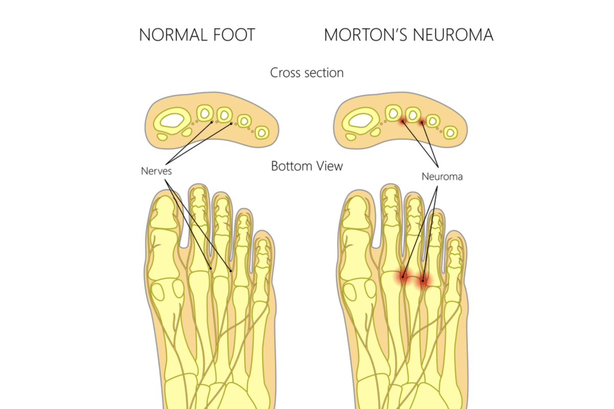Mumbai Knee Foot Ankle Clinic